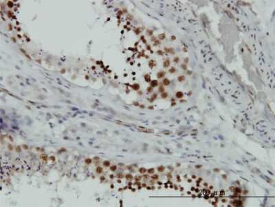 Immunohistochemistry-Paraffin: HMGB2 Antibody (3E5) [H00003148-M05]