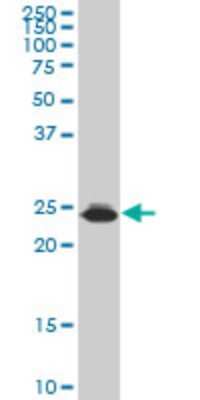 Western Blot: HMGB2 Antibody (3F2) [H00003148-M06]