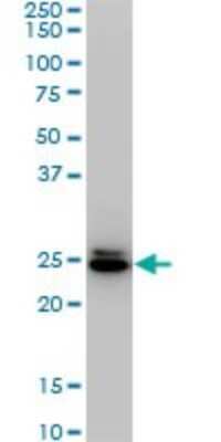 Western Blot: HMGB2 Antibody (4G7) [H00003148-M02]