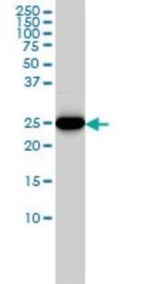 Western Blot: HMGB2 Antibody (4G7) [H00003148-M02]