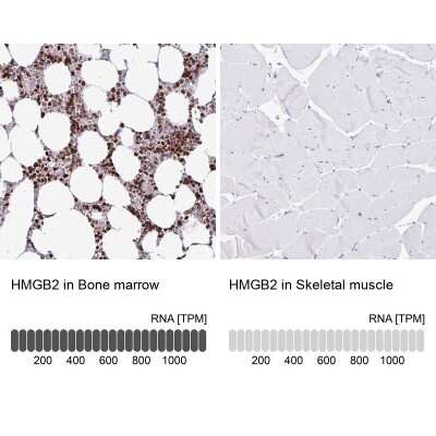Immunohistochemistry-Paraffin: HMGB2 Antibody [NBP2-38694]