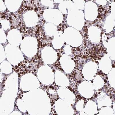 Immunohistochemistry-Paraffin: HMGB2 Antibody [NBP2-38694]