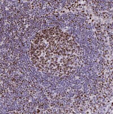 Immunohistochemistry-Paraffin: HMGB2 Antibody [NBP2-38694]