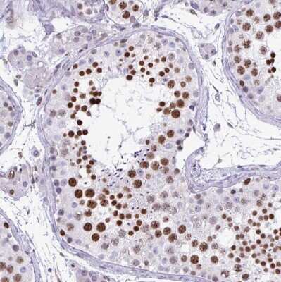 Immunohistochemistry-Paraffin: HMGB2 Antibody [NBP2-38694]