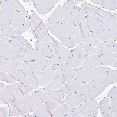 Immunohistochemistry-Paraffin: HMGB2 Antibody [NBP2-38694]