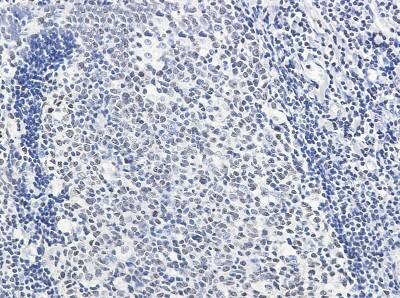 Immunohistochemistry-Paraffin: HMGB2 Antibody (S02-5I5) [NBP3-19876]