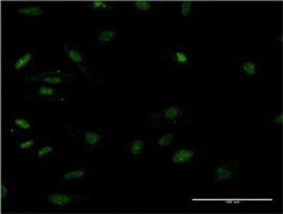Immunocytochemistry/ Immunofluorescence: HMGB2 Antibody (X1) [H00003148-M07]