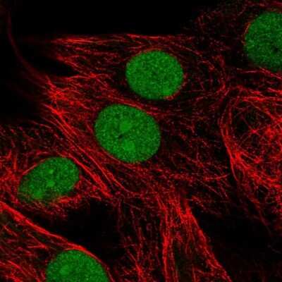 Immunocytochemistry/ Immunofluorescence: HMGB3/HMG4 Antibody [NBP2-47434]