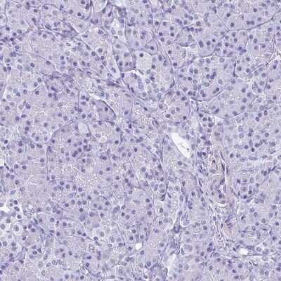 Immunohistochemistry-Paraffin: HMGB3/HMG4 Antibody [NBP2-47434]