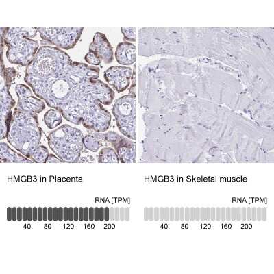 Immunohistochemistry-Paraffin: HMGB3/HMG4 Antibody [NBP2-47434]