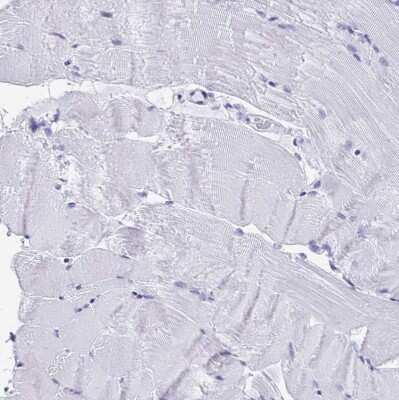 Immunohistochemistry-Paraffin: HMGB3/HMG4 Antibody [NBP2-47434]
