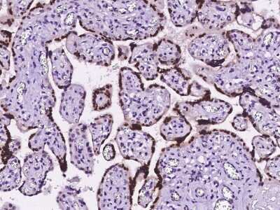 Immunohistochemistry-Paraffin: HMGB3/HMG4 Antibody [NBP2-98886]