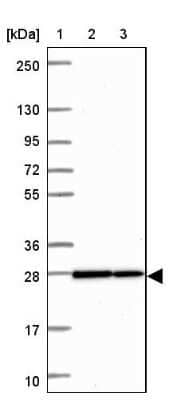 Western Blot: HMGB3/HMG4 Antibody [NBP2-47434]