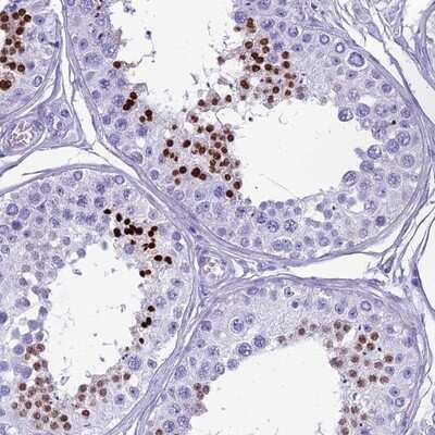 Immunohistochemistry-Paraffin: HMGB4 Antibody [NBP1-93780]