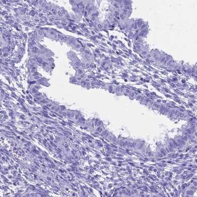 Immunohistochemistry-Paraffin: HMGB4 Antibody [NBP1-93780]
