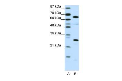 Western Blot: HMGB4 Antibody [NBP2-83050]