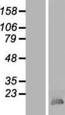 Western Blot: HMGB4 Overexpression Lysate [NBL1-11616]