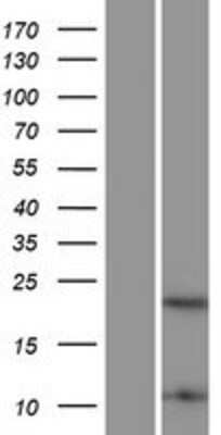 Western Blot: HMGB4 Overexpression Lysate [NBP2-09980]