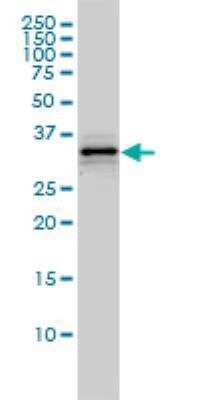 Western Blot: HMGCL Antibody (4F4-D1) [H00003155-M01]