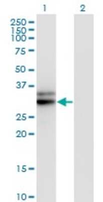 Western Blot: HMGCL Antibody (4F4-D1) [H00003155-M01]