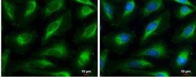 Immunocytochemistry/ Immunofluorescence: HMGCL Antibody [NBP1-32767]