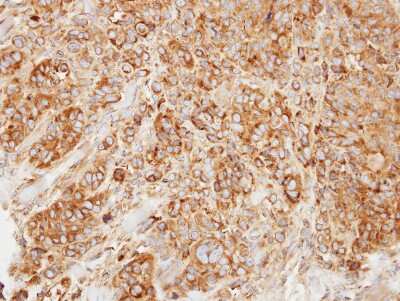 Immunohistochemistry-Paraffin: HMGCL Antibody [NBP1-32767]