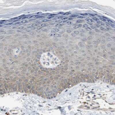 Immunohistochemistry-Paraffin: HMGCL Antibody [NBP1-83251]