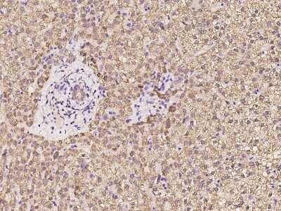 Immunohistochemistry-Paraffin: HMGCL Antibody [NBP2-97971]