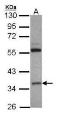 Western Blot: HMGCL Antibody [NBP1-32767]