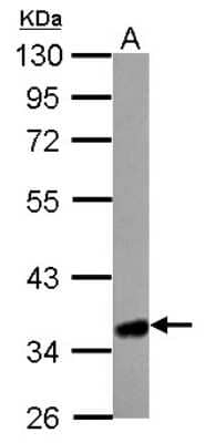 Western Blot: HMGCL Antibody [NBP1-32767]