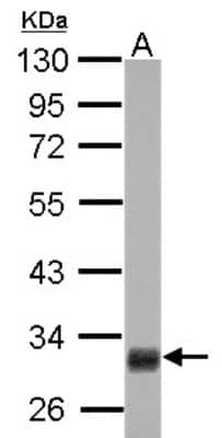 Western Blot: HMGCL Antibody [NBP1-32767]