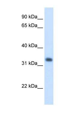 Western Blot: HMGCL Antibody [NBP1-58026]