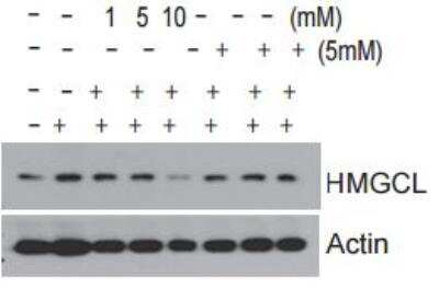 Western Blot: HMGCL Antibody [NBP1-58026]