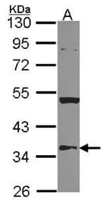 Western Blot: HMGCL Antibody [NBP2-16860]