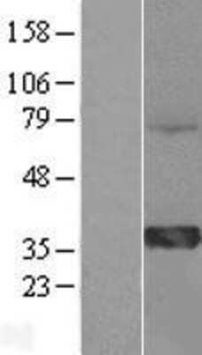 Western Blot: HMGCL Overexpression Lysate [NBL1-11617]