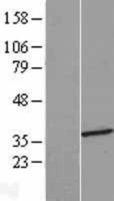 Western Blot: HMGCLL1 Overexpression Lysate [NBL1-11618]