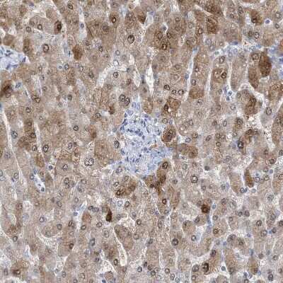 Immunohistochemistry: HMGCS1 Antibody [NBP1-83246]