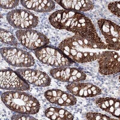 Immunohistochemistry-Paraffin: HMGCS1 Antibody [NBP2-14094]