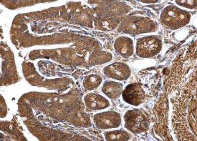 Immunohistochemistry-Paraffin: HMGCS1 Antibody [NBP2-16861]