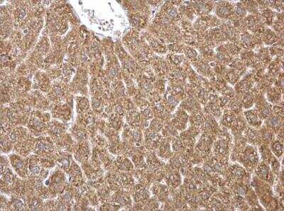 Immunohistochemistry-Paraffin: HMGCS1 Antibody [NBP2-16861]