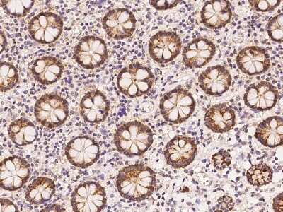 Immunohistochemistry-Paraffin: HMGCS1 Antibody [NBP2-97737]
