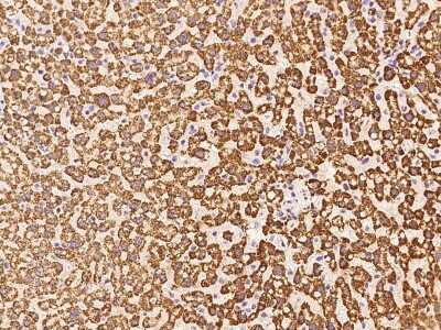 Immunohistochemistry-Paraffin: HMGCS1 Antibody [NBP2-97737]