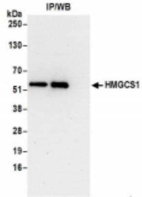 Immunoprecipitation: HMGCS1 Antibody [NBP2-36554]