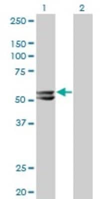 Western Blot: HMGCS2 Antibody (1E9) [H00003158-M06]