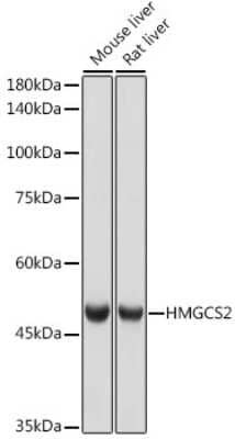 Western Blot: HMGCS2 Antibody (5T5T3) [NBP3-15696]