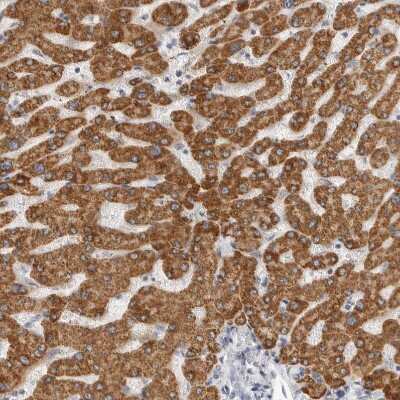 Immunohistochemistry-Paraffin: HMGCS2 Antibody [NBP2-33908]