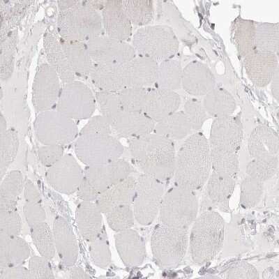 Immunohistochemistry-Paraffin: HMGCS2 Antibody [NBP2-33908]