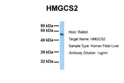 Western Blot: HMGCS2 Antibody [NBP1-54869]