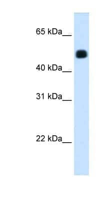 Western Blot: HMGCS2 Antibody [NBP1-54995]