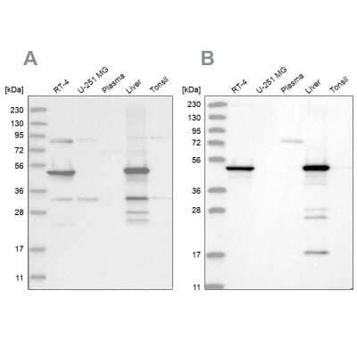 Western Blot: HMGCS2 Antibody [NBP2-33907]